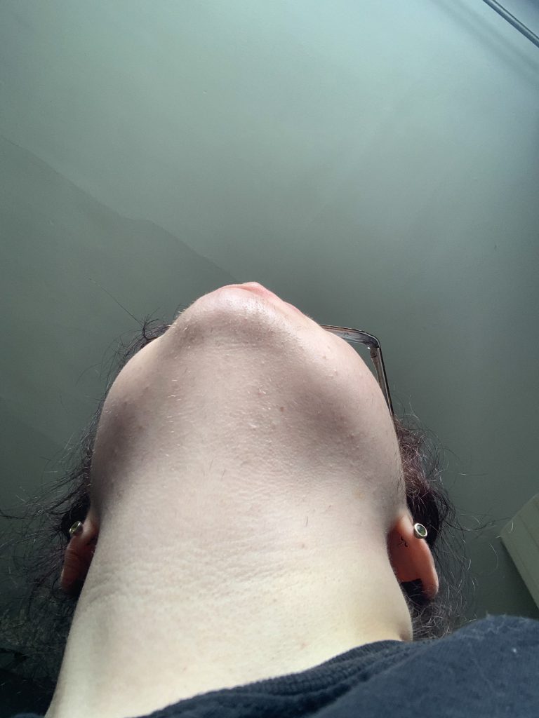 Image of white cis female face pointing upwards to reveal facial hair on chin.